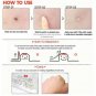 NEW COSRX Acne Pimple Master Patch  6 sheets X 24 Patches Reduce Acne Spots