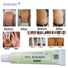 5 packaging. Cream for the treatment of psoriasis, eczema, dermatitis. Natural ingredient.