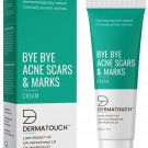 DERMATOUCH Bye Bye Acne Scars & Marks Cream For All Skin Types - 30G