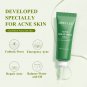Tea Tree Salicylic Acid Acne Treatment Gel Anti Acne Gel Cream