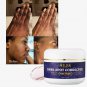 Ailke Dark Spot Corrector Cream Fade Age Spot Discoloration Sun Spot  3.53 fl oz