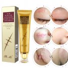 Scar Repair Dark Spot Removal  Gel Pimples Acne Scar Mark Blemish