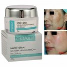 Strong Melasma Freckle Melanin Dark Spot Removal Whitening Cream 25g
