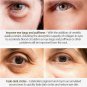 Eye Cream Dark Circles Puffiness Wrinkles Bags Anti-Aging Eye Serum
