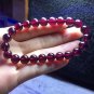 Natural and affordable type rose red garnet feminine stone gems beauty beauty help gynecology