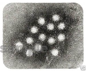 mouse pad HEPATITIS A electron microscope image