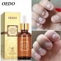 Fungal Nail Treatment Hand and Foot Whitening Toenail Fungus Removal Infection Foot Care Polish