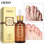 Fungal Nail Treatment Hand and Foot Whitening Toenail Fungus Removal Infection Foot Care Polish
