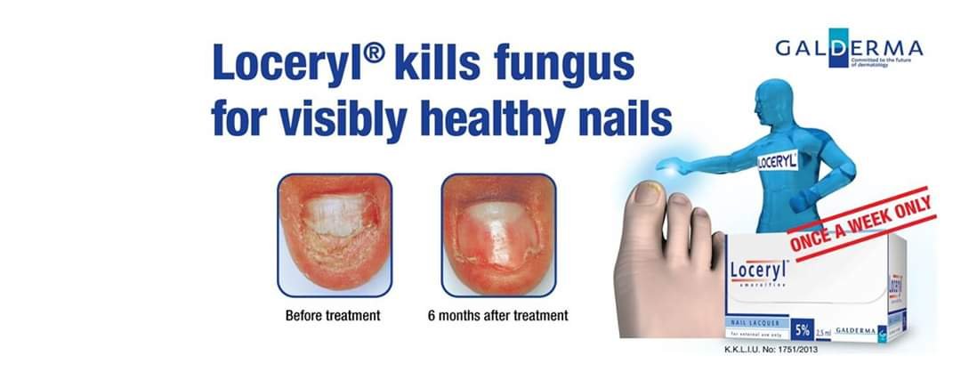 Loceryl fungal anti Loceryl Anti Fungal Nail Treatment