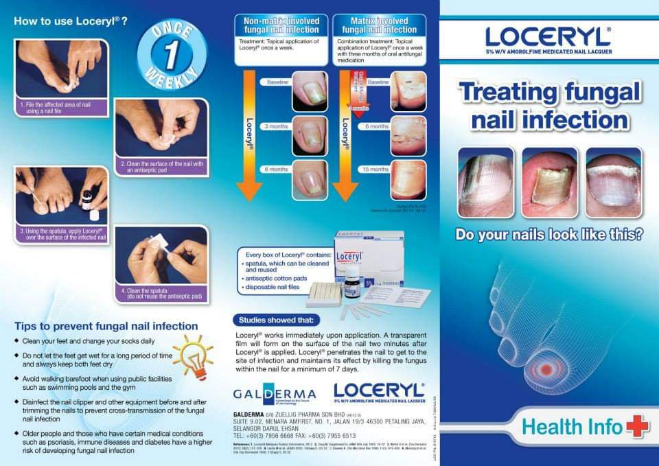 Loceryl Anti Fungal Nail Treatment