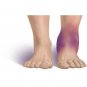Reparil Gel N 40g Anti-Inflammatory, Pain Relieving & Swelling FREE SHIPPING