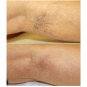 Reparil Gel N 40g Anti-Inflammatory, Pain Relieving & Swelling FREE SHIPPING