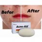 10 pcs ACNE-AID Face & Body Soap Bar Oil Control 100g For Acne Prone and Oily Skin