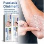 2 X Psoriasis Dermatitis Eczema Natural Cream Skin Treatment Ointment FREE SHIP