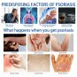 2 X Psoriasis Dermatitis Eczema Natural Cream Skin Treatment Ointment FREE SHIP