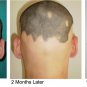 Discover the Underlying Causes of Hair Loss/ How to Avoid Losing Hair/ 71 Coloring pages.