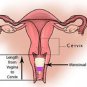 VIVA CUP Menstrual Reusable Cup 12 Hour Period Protection Size LG