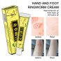 Herbal Eczmea Antibacterial Dermatitis Psoriasis Cream Anti-itch Skin Allergy Ringworm Itching