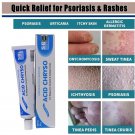 2x Crema Para Dermatitis Eczema Psoriasis Para Comezon Picazon Ronchas En La Piel