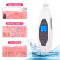 LCD digital exfoliating shovel
