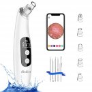 Blackhead Remover with Camera