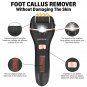 Electric Foot Callus Remover Rechargeable Pedicure Tools Kit Feet Scrubber