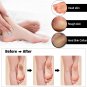 Electric Foot Callus Remover Rechargeable Pedicure Tools Kit Feet Scrubber