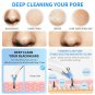 Blackhead Remover Vacuum Blackhead removal tool Blackhead Vacuum