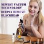 Blackhead Remover Pore Vacuum