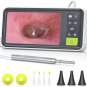 Digital Otoscope with Gyroscope, 4.5 Inches Screen, 3.9Mm Ear Scope Camera with