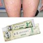 Zudaifu Skin Psoriasis Cream Dermatitis Eczema Acne Ointment Skin Care with Box Free Shipping
