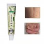 5 PCS Zudaifu Skin Psoriasis Cream Dermatitis Eczema Acne Ointment Skin Care USA Stock Free Shipping