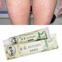 5 PCS Zudaifu Skin Psoriasis Cream Dermatitis Eczema Acne Ointment Skin Care USA Stock Free Shipping