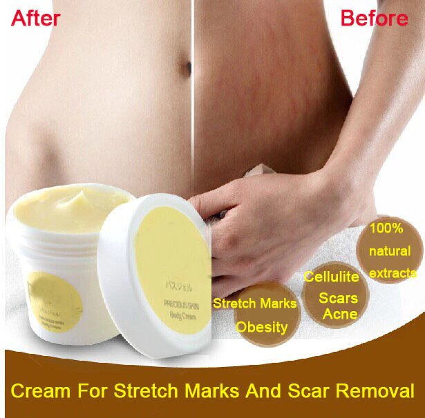 Pasjel Cream Stretch Marks Remover Skin Body Pregnancy Scars Removal USA Stock Free Shipping