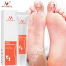 Foot Care, Cream Foot Spa Pedicure Detox Anti Infection Onychomycosis Fungus Treatment For Legs
