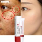 Whitening Freckle Cream Remove Melasma Cream Remove Dark Spots