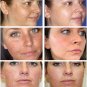 Whitening Freckle Cream Remove Melasma Cream Remove Dark Spots
