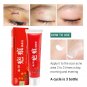 Acne Scar Removal Cream Pimples Stretch Marks Face Gel Remove