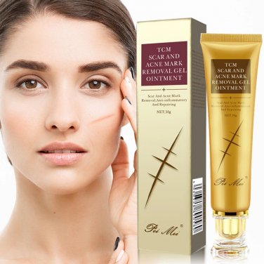 30g Acne Scar Removal Cream Pimples Stretch Marks Face Gel Remove