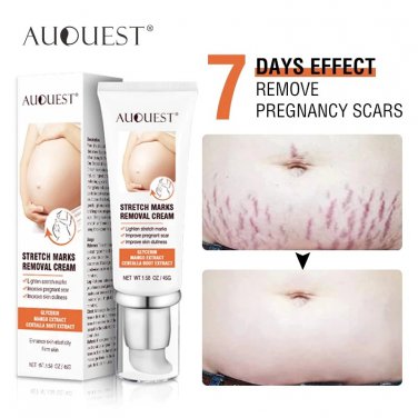 Maternity Stretch Marks Removal Cream Body Buttock Breast Mark Skin Care