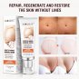 Maternity Stretch Marks Removal Cream Body Buttock Breast Mark Skin Care