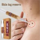 Skin Tag Remover Medical Against Moles Removal Genital Wart Acne Spot Treatment