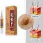 Skin Tag Remover Medical Against Moles Removal Genital Wart Acne Spot Treatment