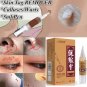 Skin Tag Remover Medical Against Moles Removal Genital Wart Acne Spot Treatment