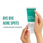 DERMATOUCH Bye Bye Acne Spot Oil Free Gel For Acne & Spot Less Clear Skin- 30gm