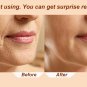 Wooden Acupressure Face Lifting Wrinkle Remover Facial Massager , 1 Pcs