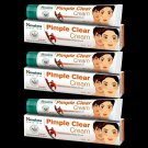 3 X Himalaya PIMPLE CLEAR CREAM 20gm with Shalmali for men & women FREE SHIP