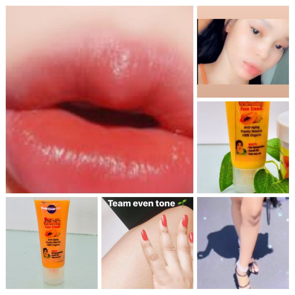 Face Whitening Cream For Dark Knees Dark Elbows Dark Underarms Dark Knuckles
