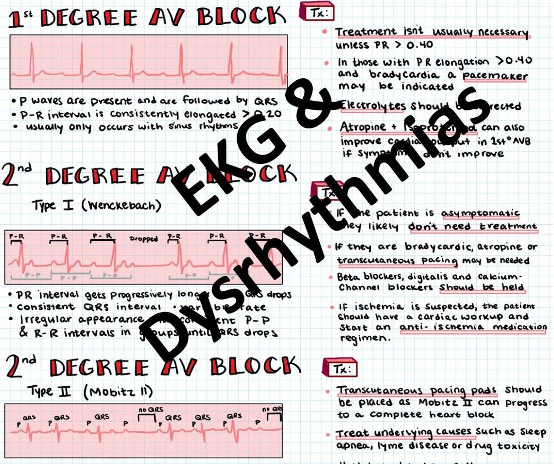 Basic EKG Interpretation & Dysrhythmias