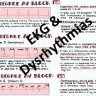 Basic EKG Interpretation & Dysrhythmias